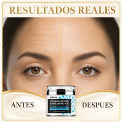 Crema Facial Colágeno, Retinol y Ácido Hialurónico GOHOSO 3